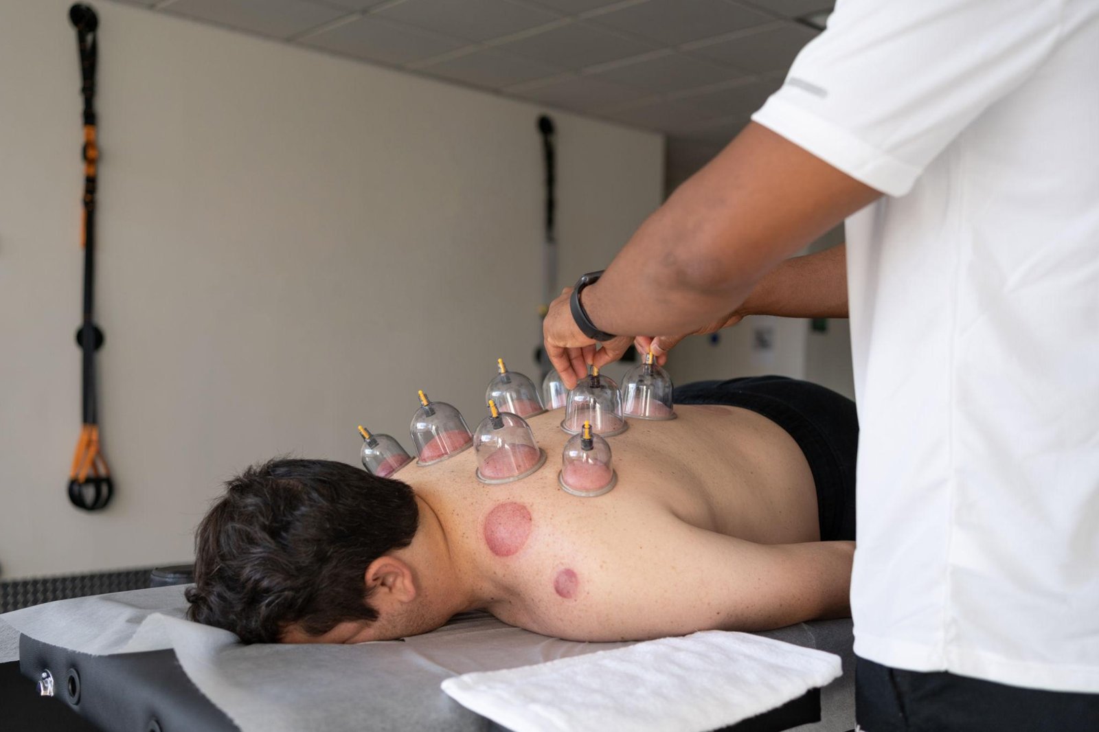 Cupping Therapy Dubai | Muscle Pain & Recovery Care